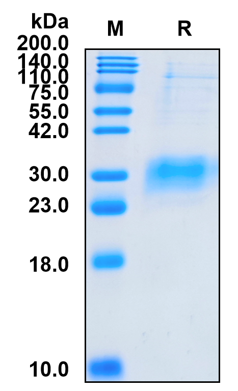 Recombinant Human FOLR2 Protein (ECD, His Tag)